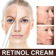 Aptisus | EELHOE Retinol Anti-Aging Cream